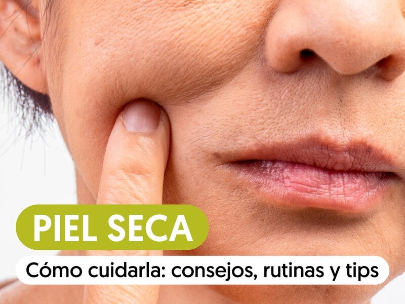 Cómo cuidar la piel seca: consejos, rutina y claves para recuperar la hidratación