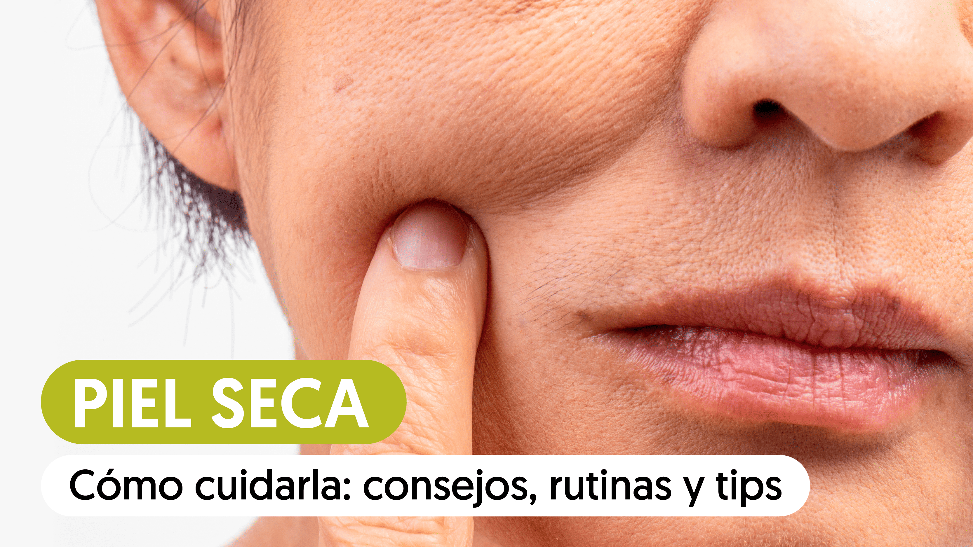 Piel seca