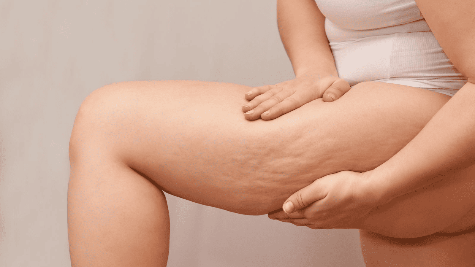 Combatir la celulitis con remedios naturales